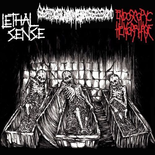 SMP/ENDOSCOPYC HEMORRHAGE/LETHAL SENSE -03 way